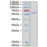 SDS-PAGE - Recombinant Human ULBP3 Protein (C-terminal Human Fc and His Tag) (A331397) - Antibodies.com