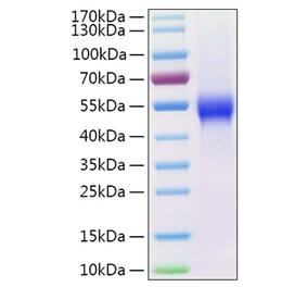 SDS-PAGE - Recombinant Human uPAR Protein (C-terminal His Tag) (A331398) - Antibodies.com