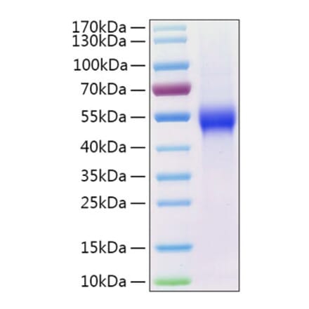 SDS-PAGE - Recombinant Human uPAR Protein (C-terminal His Tag) (A331398) - Antibodies.com