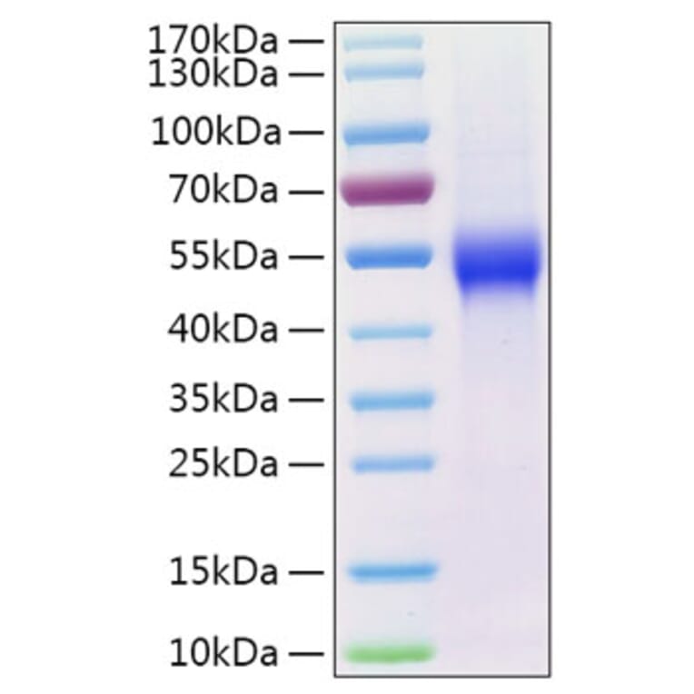 SDS-PAGE - Recombinant Human uPAR Protein (C-terminal His Tag) (A331398) - Antibodies.com