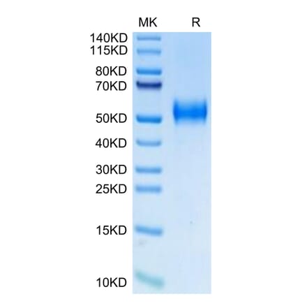 Tris-Bis PAGE - Recombinant Human uPAR Protein (Biotin) (C-terminal His and Avi Tag) (A331399) - Antibodies.com