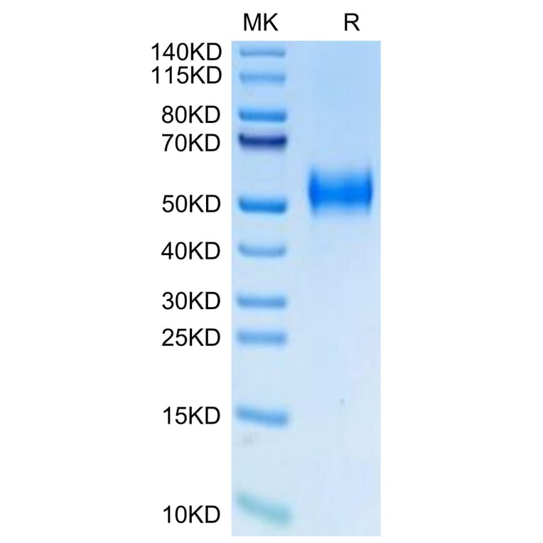 Tris-Bis PAGE - Recombinant Human uPAR Protein (Biotin) (C-terminal His and Avi Tag) (A331399) - Antibodies.com