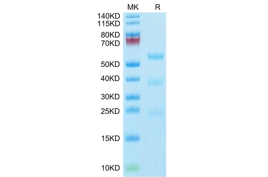 Tris-Bis PAGE - Recombinant Human Urokinase Protein (Biotin) (C-terminal His and Avi Tag) (A331400) - Antibodies.com