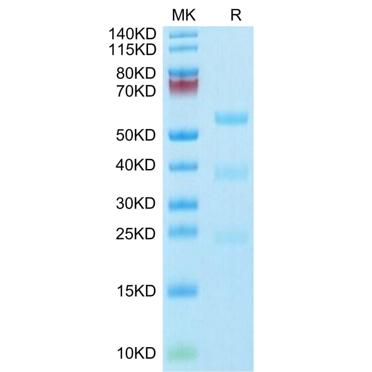 Tris-Bis PAGE - Recombinant Human Urokinase Protein (Biotin) (C-terminal His and Avi Tag) (A331400) - Antibodies.com