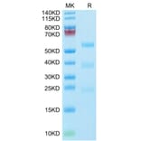 Tris-Bis PAGE - Recombinant Human Urokinase Protein (Biotin) (C-terminal His and Avi Tag) (A331400) - Antibodies.com