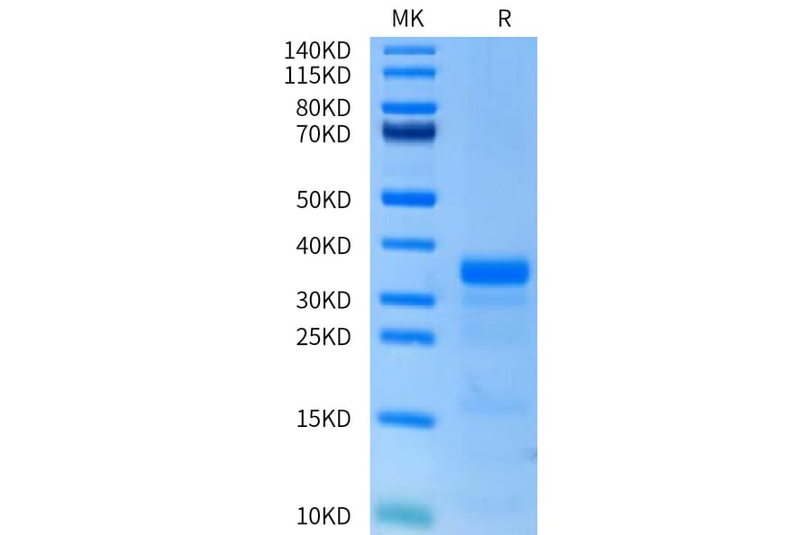 Tris-Bis PAGE - Recombinant Human Urokinase Protein (C-terminal His Tag) (A331401) - Antibodies.com