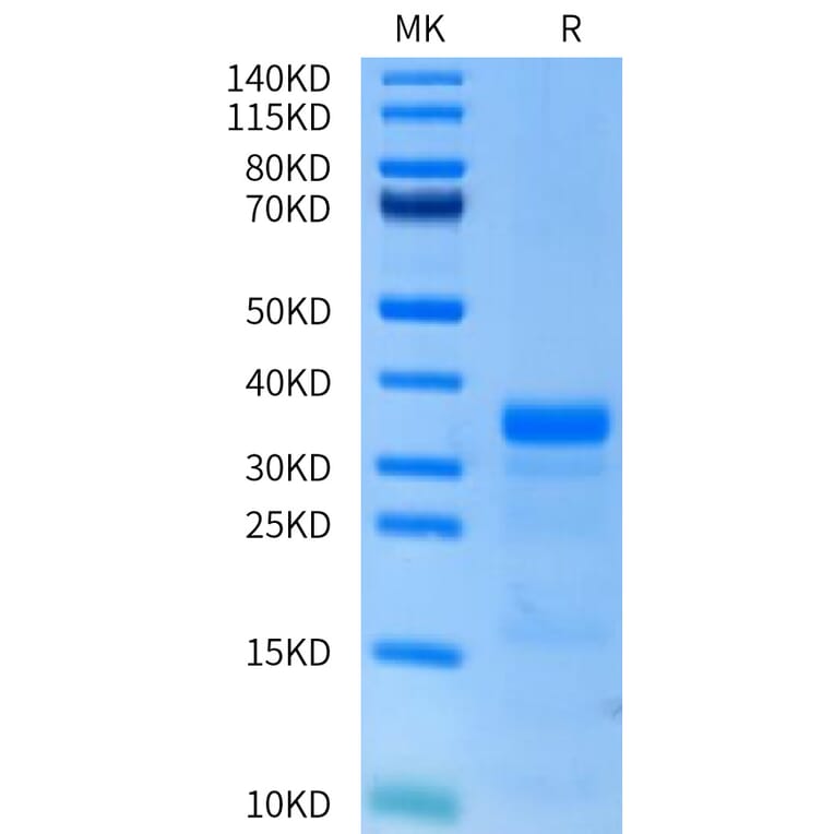 Tris-Bis PAGE - Recombinant Human Urokinase Protein (C-terminal His Tag) (A331401) - Antibodies.com