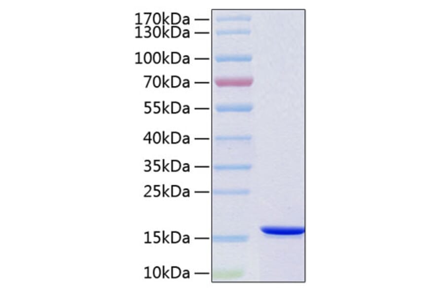 SDS-PAGE - Recombinant Human VAPB Protein (C-terminal His Tag) (A331402) - Antibodies.com