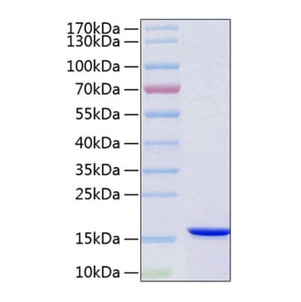 SDS-PAGE - Recombinant Human VAPB Protein (C-terminal His Tag) (A331402) - Antibodies.com