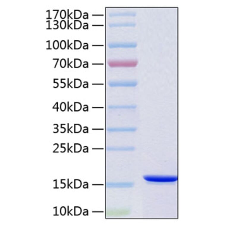 SDS-PAGE - Recombinant Human VAPB Protein (C-terminal His Tag) (A331402) - Antibodies.com