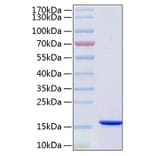 SDS-PAGE - Recombinant Human VAPB Protein (C-terminal His Tag) (A331402) - Antibodies.com
