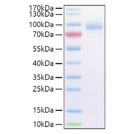 SDS-PAGE - Recombinant Human Vasorin Protein (C-terminal His Tag) (A331403) - Antibodies.com