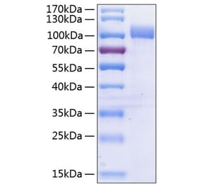 SDS-PAGE - Recombinant Human VCAM-1 Protein (C-terminal His Tag) (A331404) - Antibodies.com