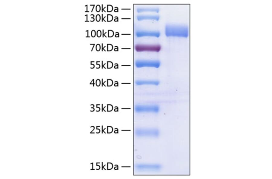 SDS-PAGE - Recombinant Human VCAM-1 Protein (C-terminal His Tag) (A331404) - Antibodies.com