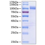 SDS-PAGE - Recombinant Human VCAM-1 Protein (C-terminal His Tag) (A331404) - Antibodies.com
