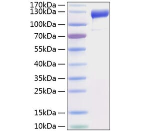 SDS-PAGE - Recombinant Human VEGF Receptor 1 Protein (C-terminal His Tag) (A331406) - Antibodies.com