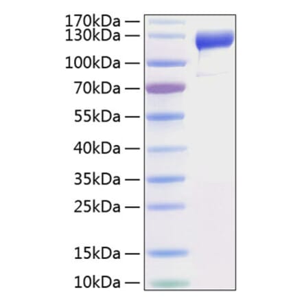 SDS-PAGE - Recombinant Human VEGF Receptor 1 Protein (C-terminal His Tag) (A331406) - Antibodies.com