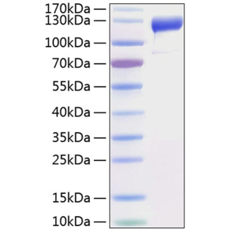 SDS-PAGE - Recombinant Human VEGF Receptor 1 Protein (C-terminal His Tag) (A331406) - Antibodies.com