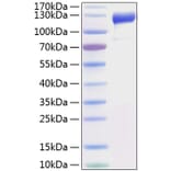 SDS-PAGE - Recombinant Human VEGF Receptor 1 Protein (C-terminal His Tag) (A331406) - Antibodies.com
