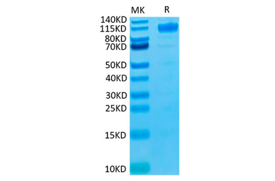 Tris-Bis PAGE - Recombinant Human VEGF Receptor 1 Protein (Biotin) (C-terminal His and Avi Tag) (A331407) - Antibodies.com