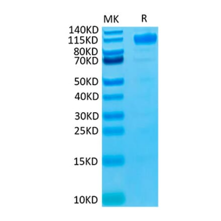 Tris-Bis PAGE - Recombinant Human VEGF Receptor 1 Protein (Biotin) (C-terminal His and Avi Tag) (A331407) - Antibodies.com