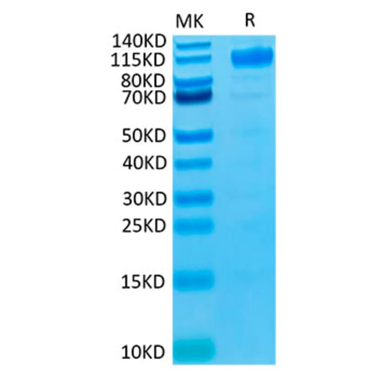 Tris-Bis PAGE - Recombinant Human VEGF Receptor 1 Protein (Biotin) (C-terminal His and Avi Tag) (A331407) - Antibodies.com