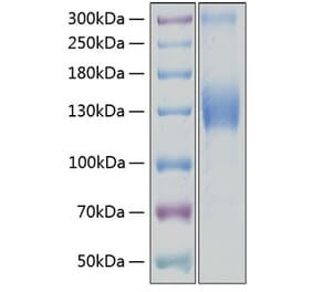 SDS-PAGE - Recombinant Human VEGF Receptor 2 Protein (C-terminal His Tag) (A331408) - Antibodies.com