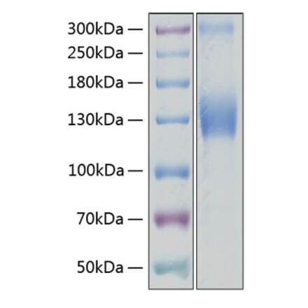 SDS-PAGE - Recombinant Human VEGF Receptor 2 Protein (C-terminal His Tag) (A331408) - Antibodies.com