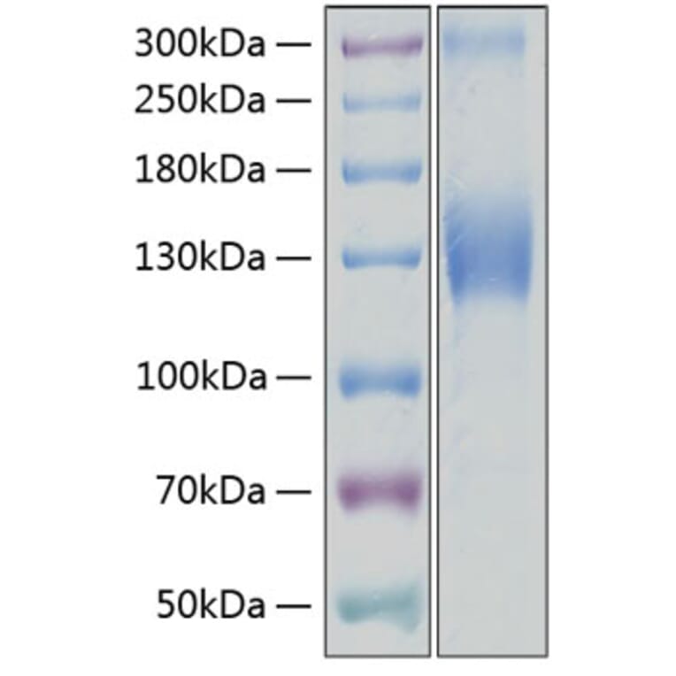 SDS-PAGE - Recombinant Human VEGF Receptor 2 Protein (C-terminal His Tag) (A331408) - Antibodies.com
