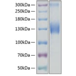 SDS-PAGE - Recombinant Human VEGF Receptor 2 Protein (C-terminal His Tag) (A331408) - Antibodies.com
