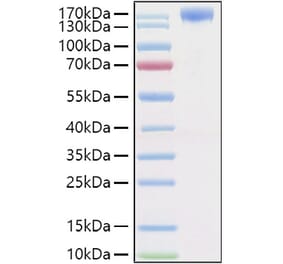 SDS-PAGE - Recombinant Human VEGF Receptor 2 Protein (C-terminal Human Fc and His Tag) (A331409) - Antibodies.com