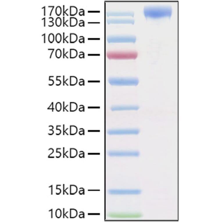 SDS-PAGE - Recombinant Human VEGF Receptor 2 Protein (C-terminal Human Fc and His Tag) (A331409) - Antibodies.com