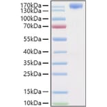 SDS-PAGE - Recombinant Human VEGF Receptor 2 Protein (C-terminal Human Fc and His Tag) (A331409) - Antibodies.com