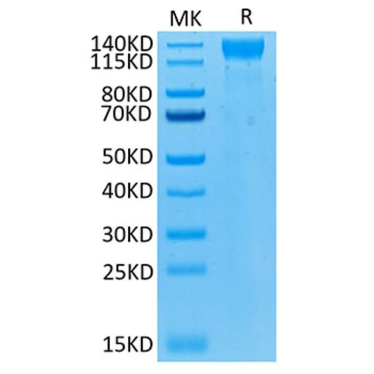 Tris-Bis PAGE - Recombinant Human VEGF Receptor 2 Protein (Biotin) (C-terminal His and Avi Tag) (A331410) - Antibodies.com