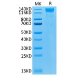 Tris-Bis PAGE - Recombinant Human VEGF Receptor 2 Protein (Biotin) (C-terminal His and Avi Tag) (A331410) - Antibodies.com