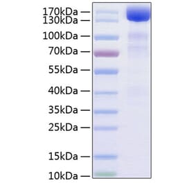 SDS-PAGE - Recombinant Human VEGF Receptor 3 Protein (C-terminal Human Fc and His Tag) (A331411) - Antibodies.com