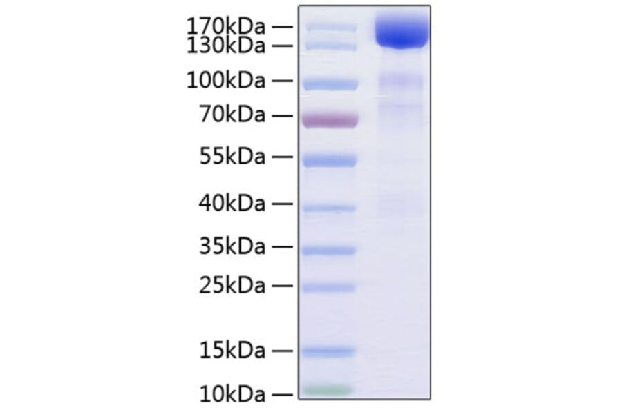 SDS-PAGE - Recombinant Human VEGF Receptor 3 Protein (C-terminal Human Fc and His Tag) (A331411) - Antibodies.com