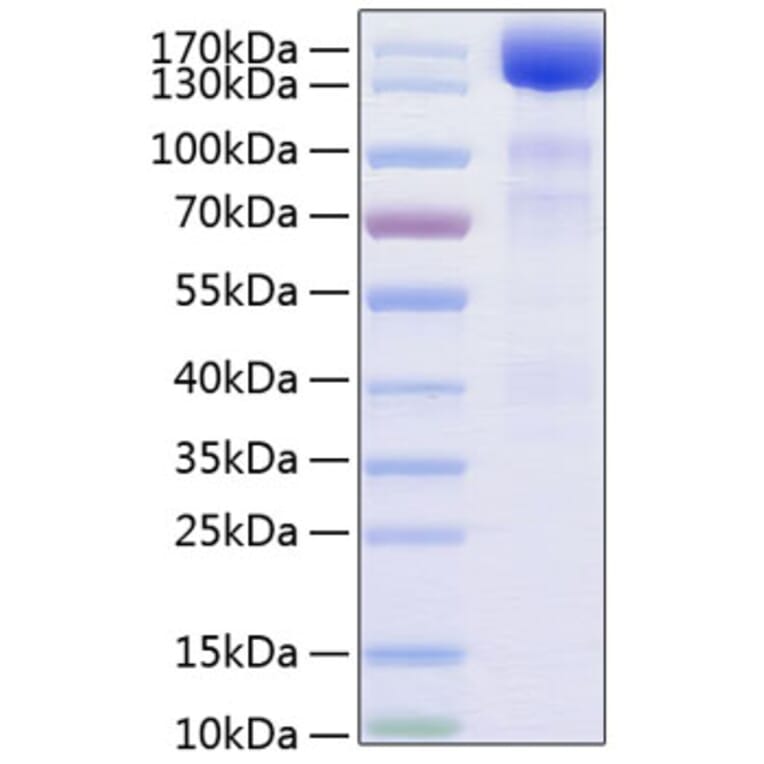 SDS-PAGE - Recombinant Human VEGF Receptor 3 Protein (C-terminal Human Fc and His Tag) (A331411) - Antibodies.com