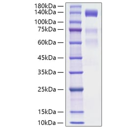SDS-PAGE - Recombinant Human VEGF Receptor 3 Protein (C-terminal His Tag) (A331412) - Antibodies.com