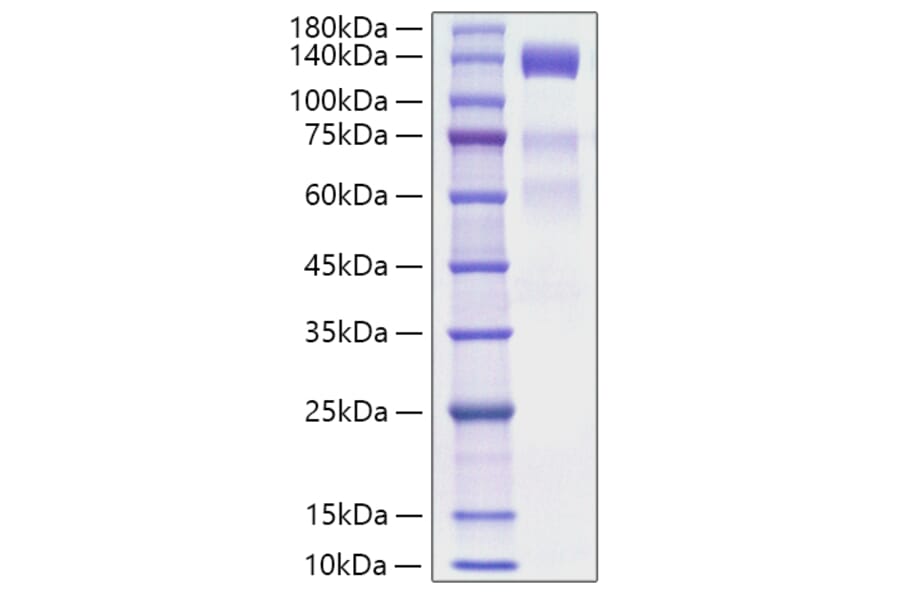 SDS-PAGE - Recombinant Human VEGF Receptor 3 Protein (C-terminal His Tag) (A331412) - Antibodies.com