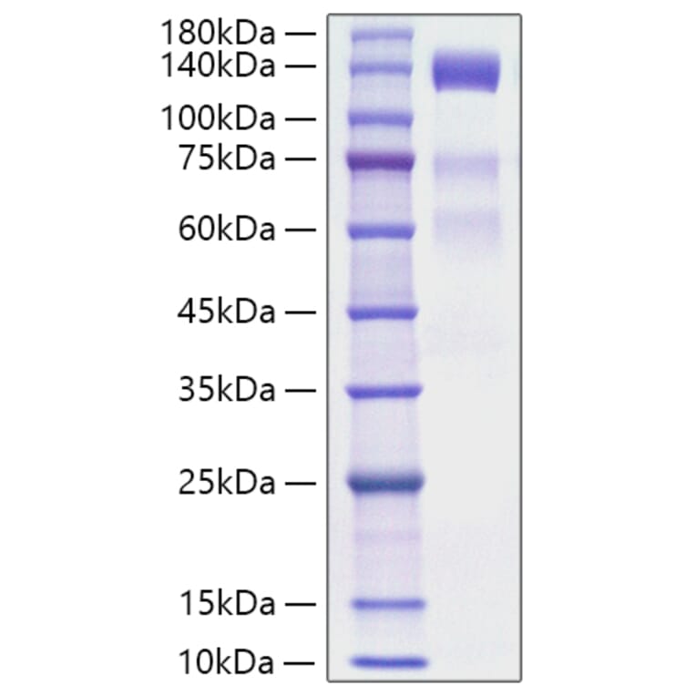 SDS-PAGE - Recombinant Human VEGF Receptor 3 Protein (C-terminal His Tag) (A331412) - Antibodies.com