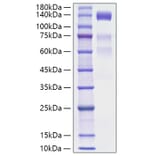 SDS-PAGE - Recombinant Human VEGF Receptor 3 Protein (C-terminal His Tag) (A331412) - Antibodies.com