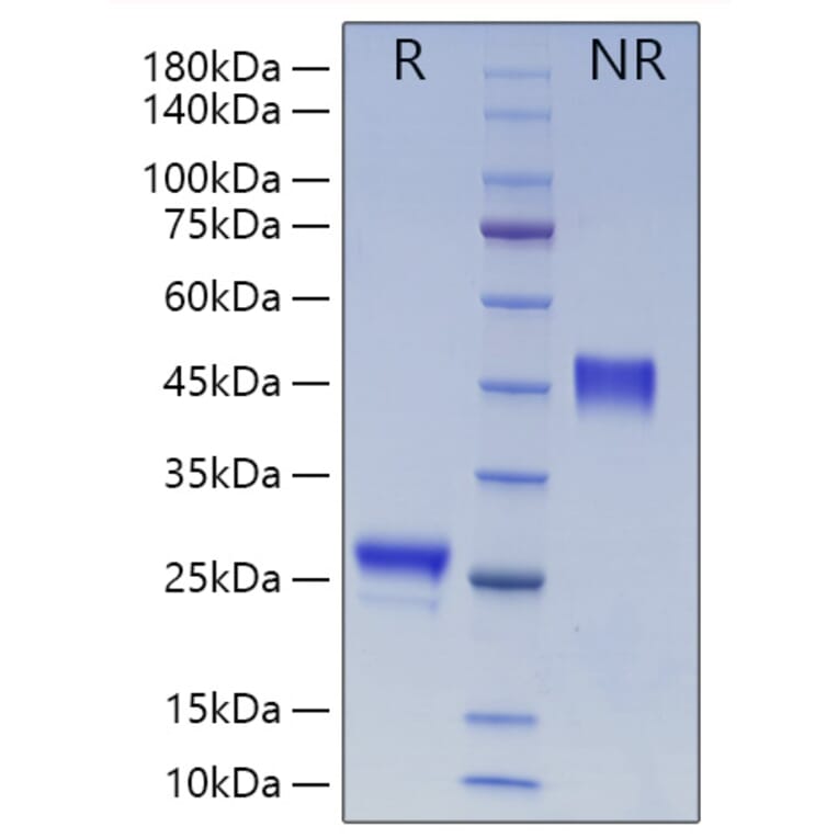 SDS-PAGE - Recombinant Human VEGFA Protein (N-terminal His Tag) (A331414) - Antibodies.com