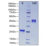 SDS-PAGE - Recombinant Human VEGFA Protein (N-terminal His Tag) (A331414) - Antibodies.com