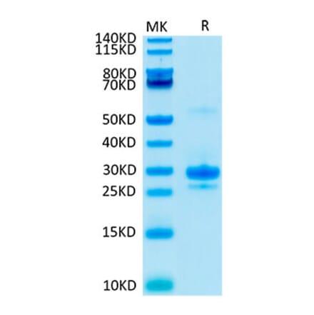 Tris-Bis PAGE - Recombinant Human VEGFA Protein (Biotin) (C-terminal His and Avi Tag) (A331415) - Antibodies.com