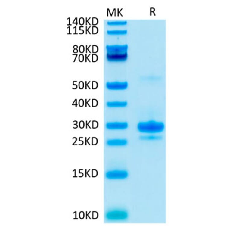Tris-Bis PAGE - Recombinant Human VEGFA Protein (Biotin) (C-terminal His and Avi Tag) (A331415) - Antibodies.com