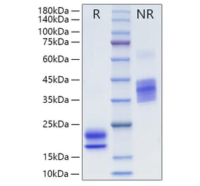 SDS-PAGE - Recombinant Human VEGFA Protein (N-terminal His Tag) (A331416) - Antibodies.com