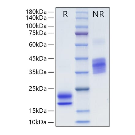 SDS-PAGE - Recombinant Human VEGFA Protein (N-terminal His Tag) (A331416) - Antibodies.com