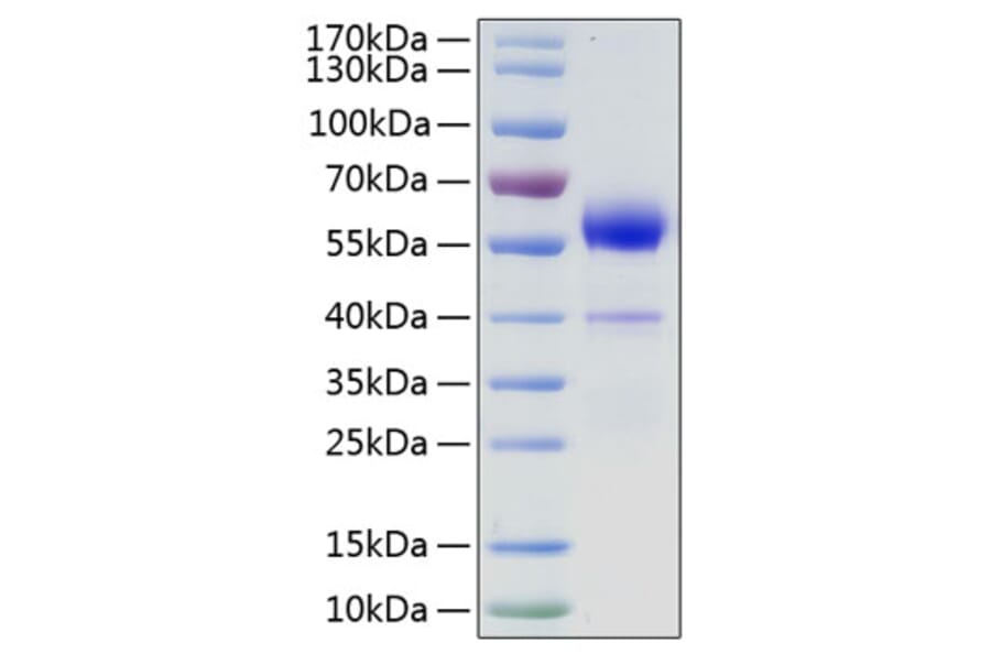 SDS-PAGE - Recombinant Human VEGF-B Protein (N-terminal Human Fc Tag) (A331417) - Antibodies.com