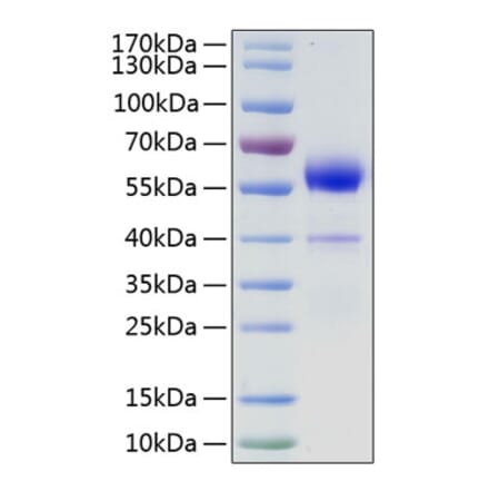 SDS-PAGE - Recombinant Human VEGF-B Protein (N-terminal Human Fc Tag) (A331417) - Antibodies.com